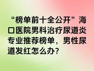 “榜单前十全公开”海口医院男科治疗尿道炎专业推荐榜单，男性尿道发红怎么办？